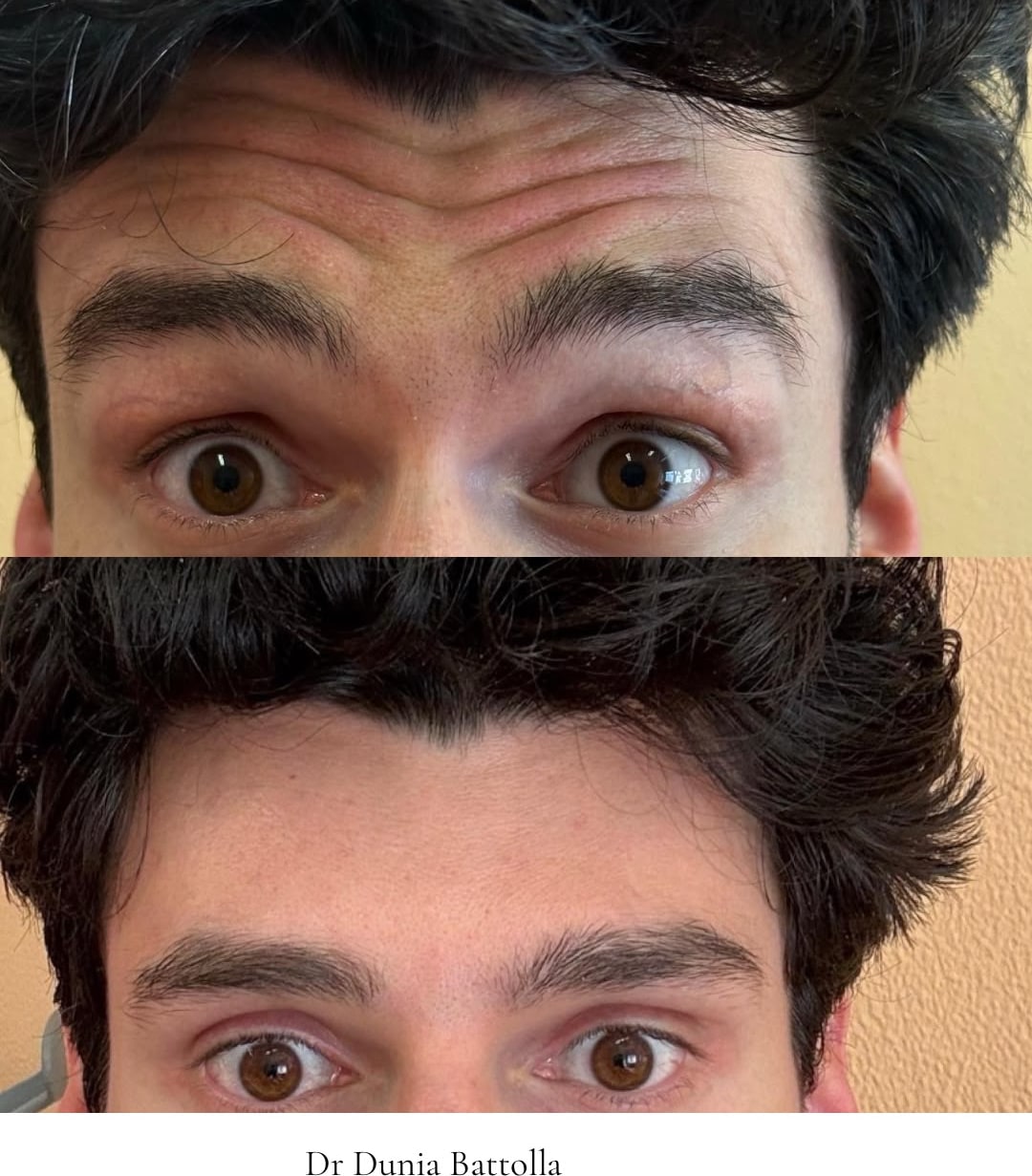 Prima e dopo i trattamenti 26