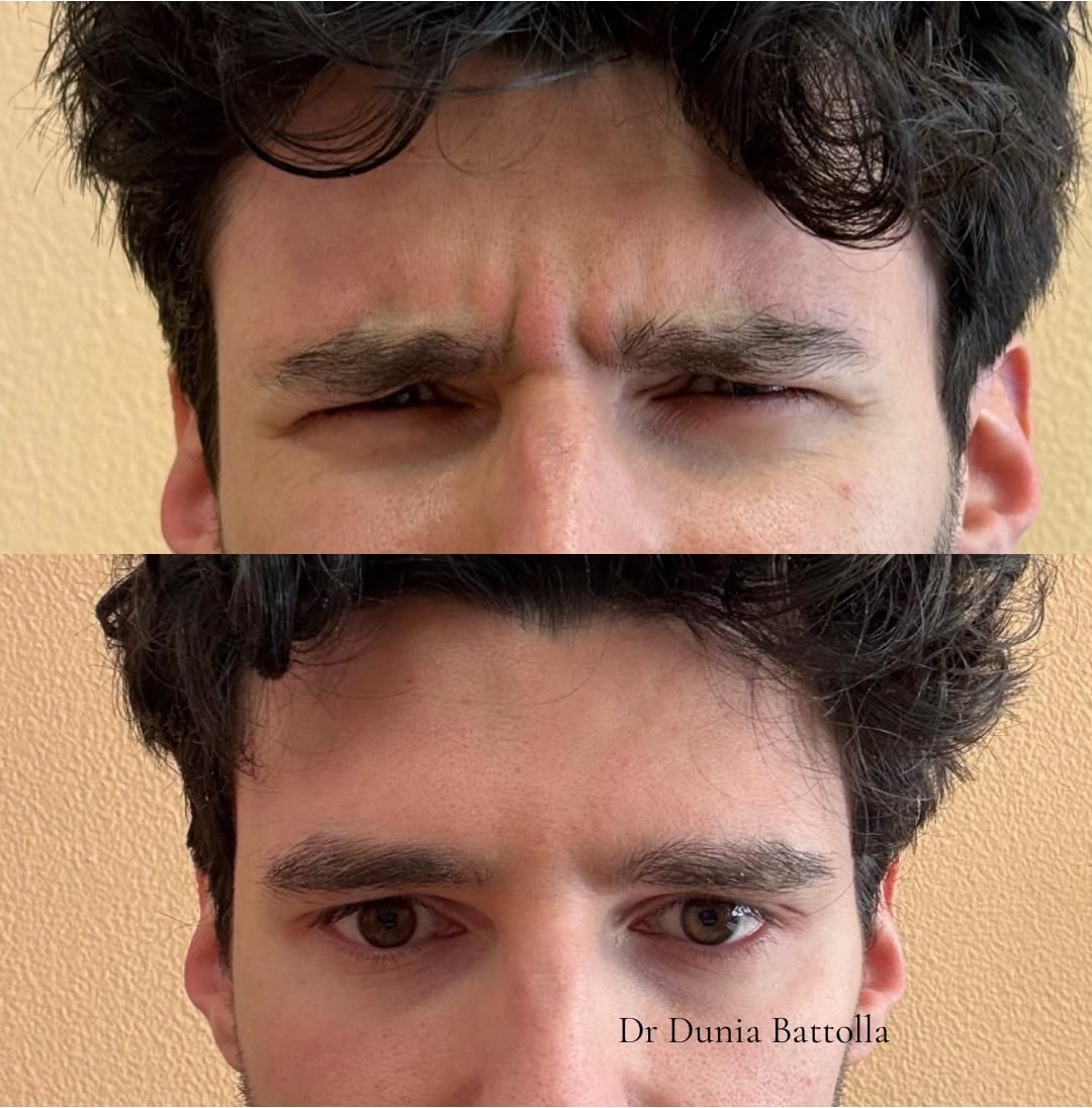 Prima e dopo i trattamenti 27